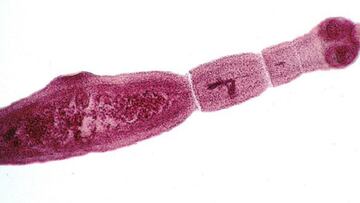 Canadá alerta de otra enfermedad potencialmente letal, la equinococosis alveolar