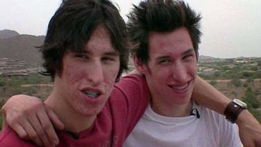 El resultado de gastar 17.000 euros para ser como Brad Pitt