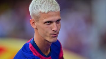 Euro 2024 winner Olmo, Barça’s big summer signing, is still waiting to make his debut after missing victories against Valencia and Athletic Club.