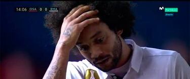 Osasuna-Real Madrid: Tano Bonnín in gruesome leg injury