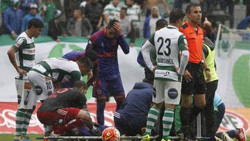 Futbol, Deportes Temuco v Universidad de Chile.
 Decimocuarta fecha, Campeonato Apertura 2016-2017.
 El jugador de Universidad de Chile Jonathan Zacaria se retira lesionado en el partido contra Deportes Temuco por primera divisin disputado en el estadio Bicentenario German Becker, Temuco, Chile.
 04/12/2016
 Dragomir Yankovic/Photosport******
 
 Football, Deportes Temuco v Universidad de Chile.
 14th date, Aperture Championship 2016-2017.
 Universidad de Chile&#039;s player Jonathan Zacaria retires injured during football match against Deportes Temuco for first division at football match held at Bicentenario German Becker stadium in Temuco, Chile.
 04/12/2016
 Dragomir Yankovic/Photosport