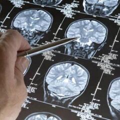 Científicos chilenos hacen uno de los descubrimientos del año: frena el envejecimiento del cerebro