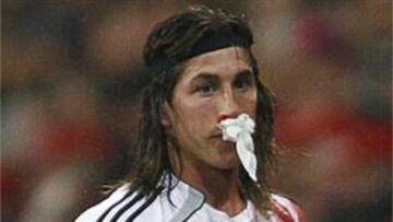 <b>ACCIDENTADO.</b> El choque con Makaay por un balón aéreo tuvo estas consecuencias para el sevillano.