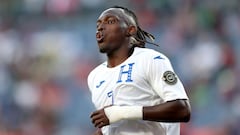 Alberth Elis habló sobre el momento que vive la Selección de Honduras y el balompié de su país; hizo énfasis en las condiciones de las canchas.