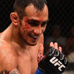 Ferguson revela que peleó con Pimblett lesionado