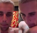 Justin Bieber alarma a sus fans en todo el mundo con su último video: el cantante no se ve bien