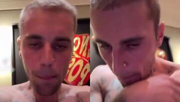 Justin Bieber alarma a sus fans en todo el mundo con su último video: el cantante no se ve bien