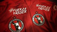 El equipo fronterizo llevara un mensaje de #FuerzaYasser en su camiseta este s&aacute;bado luego de que el defensa fuera operado por una fractura cervical.