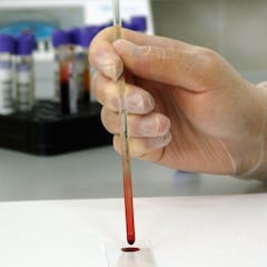 ¿Qué es la IgM y la IgG y cómo saber si he pasado la COVID con un test?