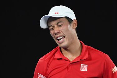 Kei Nishikori withdraws from Australian Open
