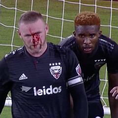 Bienvenido a la MLS: Rooney termina el partido con nariz rota