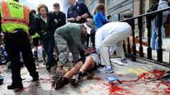 Uno de los heridos tras el estallido de dos bombas en el Marat&oacute;n de Boston del a&ntilde;o pasado.