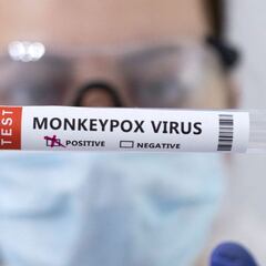 ¿Estás vacunado contra la viruela? Así lo puedes saber