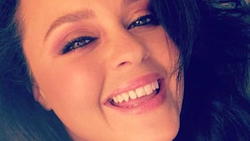 Shaila D¨²rcal cuenta al fin el escabroso motivo por el que perdi¨® parte de su dedo