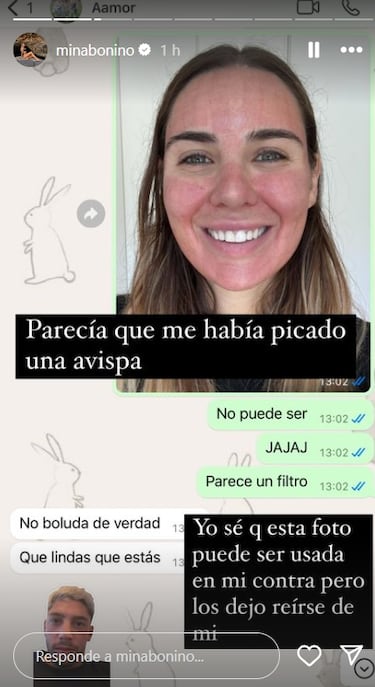 El rostro de Mina Bonino tras un tratamiento est¨¦tico: ¡°Parece que me ha picado una avispa¡±