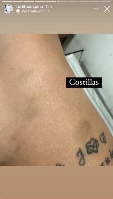 Revelan imágenes y audios de la agresión de Jean Paul Pineda a Faloon Larraguibel