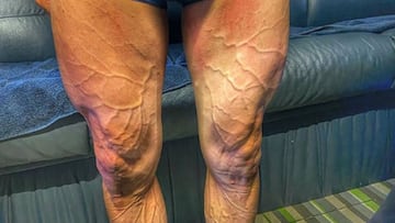 Imagen de las piernas de Jos&eacute; Joaqu&iacute;n Rojas antes de la octava etapa de La Vuelta.