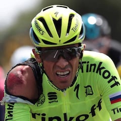 Contador, tras la caída: "Tengo el lado derecho realmente mal"