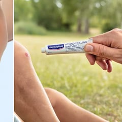 ¿Qué es bueno para quitar las cicatrices? 5 productos para cara y cuerpo