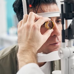 Los síntomas que alertan de un melanoma ocular, el tipo de cáncer de ojo más frecuente