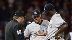 El lanzador de los Yanquis de Nueva York Michael Pineda (derecha) muestra su mano al juez Gerry Davis (izquierda). Fue expulsado por utilizar resina. 