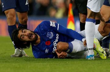 The Everton player severely fractured his ankle after a challenge with Tottenham’s Heung-Min Son, who was left devestated by the incident.