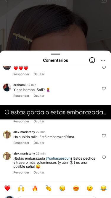  Sofía Suescun estalla ante los mensajes sobre su físico: “Hacéoslo mirar, por favor”