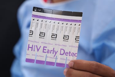 Nuevo tratamiento para el VIH aprobado en México: cómo funciona y desde cuándo se utilizará