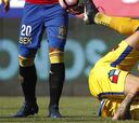 Terrible lesión de Leyton marca duelo de Unión y Everton