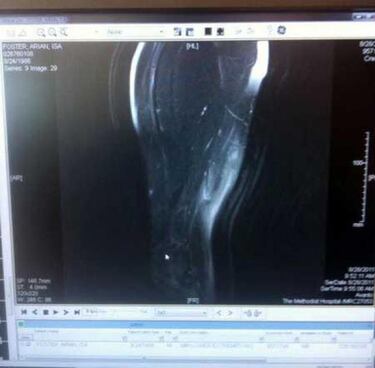 Pijaditas (sábado-semana 0)