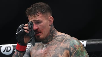 Tom Aspinall después del piquete en los ojos en el UFC 321.