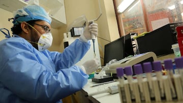 A lab technitian works on blood samples at the Cesar Garayar support hospital in the city of Iquitos, in the Amazon basin, on May 22, 2020, dedicated to endemic diseases like dengue, malaria, chikunguya and leptospirosis that still affect the population in addition to the arrival of the novel coronavirus that has claimed the lives of 14 doctors at this facility, not dedicated to harbor Covid19 cases. - Focused attention on fighting the new coronavirus in Peru has detracted the ability to combat the dengue fever, an explosive situation in the Amazon region, where it is leaving a trail of disease and death in cities and remote indigenous villages. (Photo by Cesar Von BANCELS / AFP)