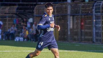 Sufrió una grave lesión y hoy su club dio un ejemplo a todo el fútbol chileno: “Volverás...”
