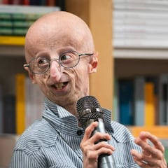 Muere la persona con progeria más longeva del mundo