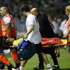 Servando Sánchez, operado de una triple fractura facial