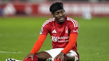 NOTTINGHAM (United Kingdom), 01/04/2025.- Anthony Elanga of Nottingham Forest reacts during the English Premier League soccer match between Nottingham Forest and Manchester United in Nottingham, Britain, 01 April 2025. (Reino Unido) EFE/EPA/TIM KEETON EDITORIAL USE ONLY. No use with unauthorized audio, video, data, fixture lists, club/league logos, 'live' services or NFTs. Online in-match use limited to 120 images, no video emulation. No use in betting, games or single club/league/player publications.