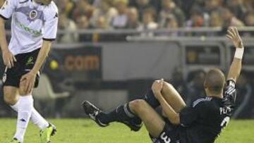 Pepe se pierde la temporada: seis meses de baja