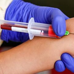 ¿Qué es el plasma y cómo lo usa el IMSS contra el coronavirus?