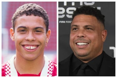 La separación tan característica que tenía entre los incisivos centrales y que tanto mostró como jugador, desapareció rápidamente cuando abandonó los terrenos de juego.