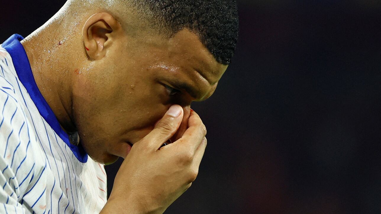 Will Kylian Mbappé play against the Netherlands? Broken nose injury