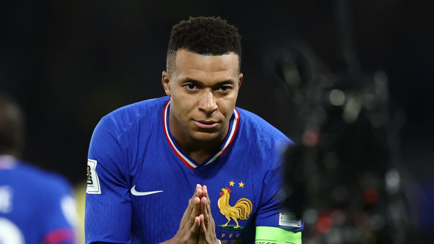 Bape mostra o rosto no camarim Bape mostra o rosto no camarim