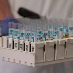 La COVID-19 actúa igual que una enfermedad de transmisión sexual