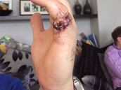 Donaldson se cortó con una motosierra: "Me peleé con ella"