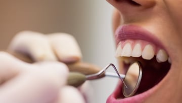 Una madre lleva a su hija al dentista y queda impactada por lo que aparece en la radiografía: “Se le atascó”