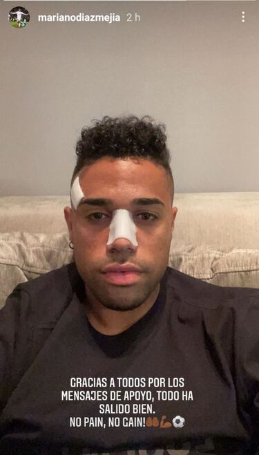 Mariano muestra su rostro tras 'partirse' la cara ante el Elche