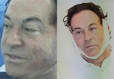 La nueva cara de Pipi Estrada tras sus retoques estéticos: “Te has quitado diez años”
