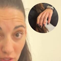 Lleva 4 horas en urgencias con la mano rota esperando y su reflexión sobre la sanidad pública es para tomar nota