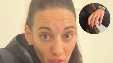 Lleva 4 horas en urgencias con la mano rota esperando y su reflexión sobre la sanidad pública es para tomar nota