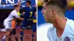 El brutal planchazo de Pavón a Toto Belmonte en el cuello