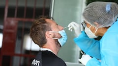 Cinco positivos por COVID-19 en Universitario de Deportes